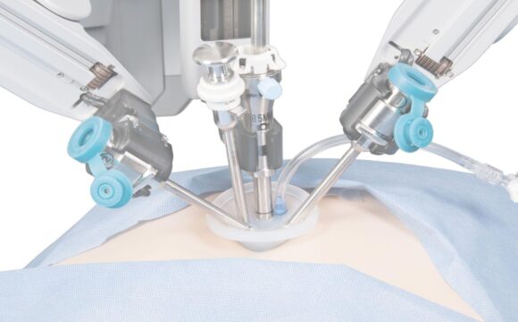 Prostat kanseri cerrahi tedavisinde Robotik Cerrahi mi Klasik Cerrahi mi?
